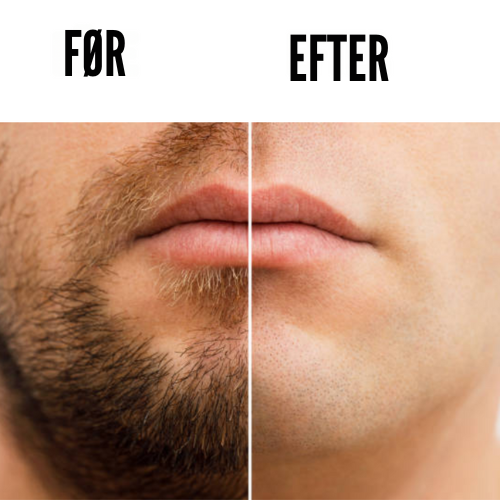 FACE SHAVER